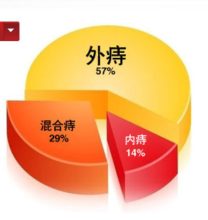 内痔外痔混合痔