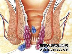 大连最好的肛肠医院