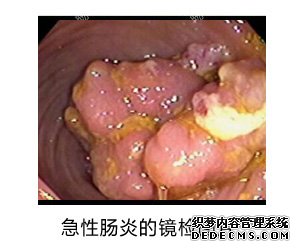 大连肛肠医院