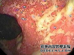 大连春柳中医肛肠医院